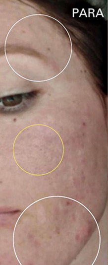 Para përdorimit të produkteve Nimor — fotografi nga kliente